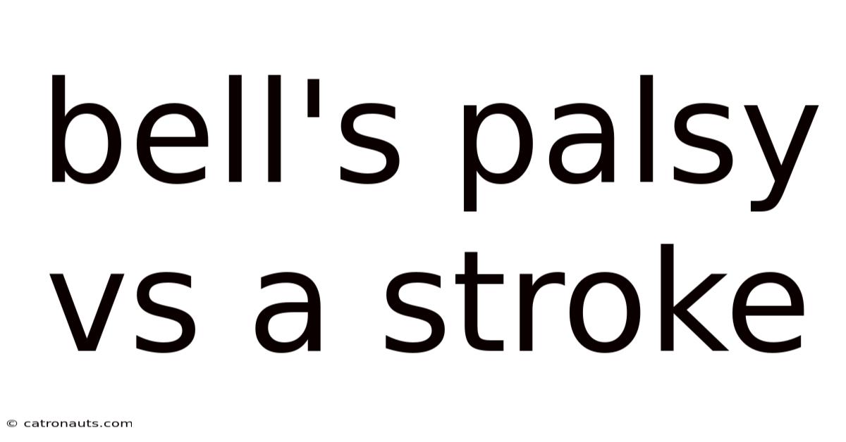 Bell's Palsy Vs A Stroke