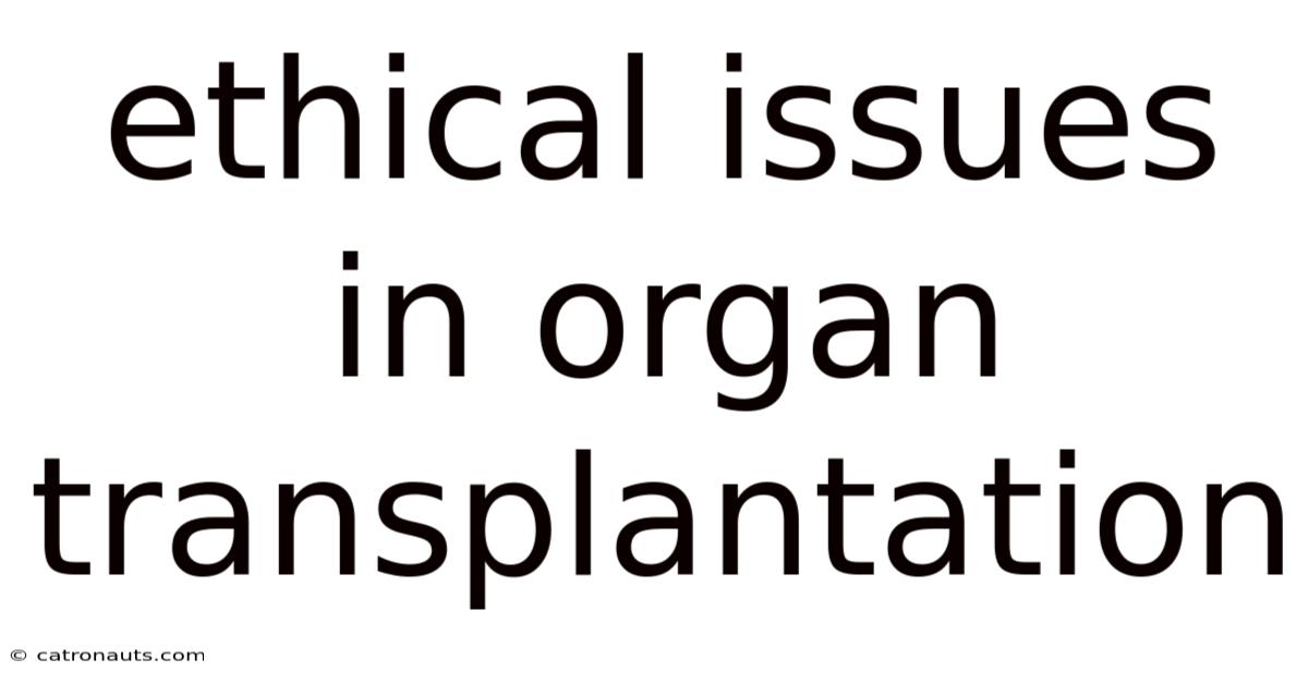 Ethical Issues In Organ Transplantation